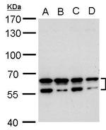 CDYL2 Antibody in Western Blot (WB)
