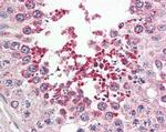 IRAK1BP1 Antibody in Immunohistochemistry (Paraffin) (IHC (P))