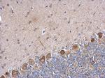 PABPC5 Polyclonal Antibody