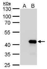Nkx2.3 Polyclonal Antibody