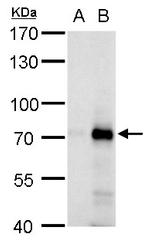 RNF168 Polyclonal Antibody