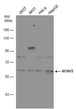 KCNV2 Polyclonal Antibody
