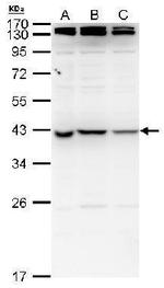 NME7 Polyclonal Antibody
