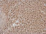 GPS1 Polyclonal Antibody