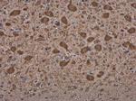 MARS Polyclonal Antibody