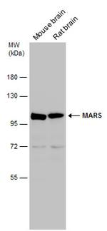 MARS Antibody in Western Blot (WB)