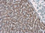 ABAT Polyclonal Antibody