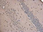 ABAT Polyclonal Antibody