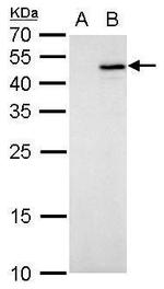 IL-28B Polyclonal Antibody