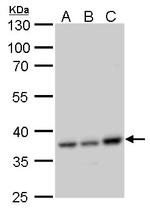 CCDC137 Polyclonal Antibody