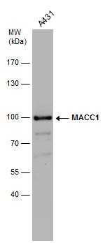 MACC1 Polyclonal Antibody