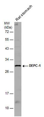 ALKBH3 Polyclonal Antibody