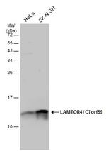 LAMTOR4 Polyclonal Antibody