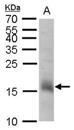 CHAC2 Antibody in Western Blot (WB)