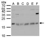CHAC2 Polyclonal Antibody