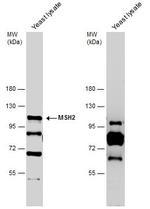 MSH2 Polyclonal Antibody