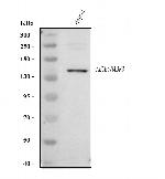 ABCB4 Polyclonal Antibody