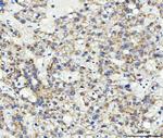 ABCB4 Polyclonal Antibody