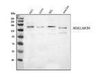 ABCB4 Antibody in Western Blot (WB)