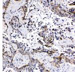 MRP1 Polyclonal Antibody