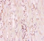 MRP4 Polyclonal Antibody
