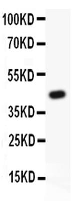 MRP4 Antibody in Western Blot (WB)