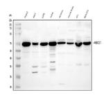 ABCE1 Antibody in Western Blot (WB)