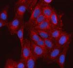 ABI1 Polyclonal Antibody