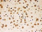 ABR Antibody in Immunohistochemistry (Paraffin) (IHC (P))