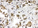 ABR Polyclonal Antibody