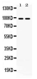 ABR Antibody in Western Blot (WB)