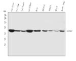 ACAA2 Antibody in Western Blot (WB)