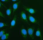 ACADVL Polyclonal Antibody