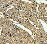 ACADVL Antibody in Immunohistochemistry (Paraffin) (IHC (P))