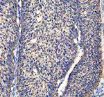ACADVL Antibody in Immunohistochemistry (Paraffin) (IHC (P))