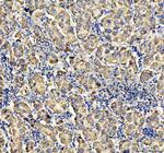 ACADVL Antibody in Immunohistochemistry (Paraffin) (IHC (P))