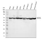 ACADVL Antibody in Western Blot (WB)
