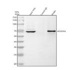 ACADVL Antibody in Western Blot (WB)