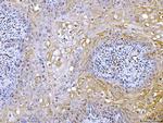 ATP Citrate Lyase Antibody in Immunohistochemistry (Paraffin) (IHC (P))