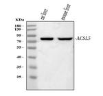 ACSL5 Polyclonal Antibody