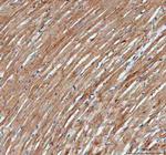 ACTA1 Antibody in Immunohistochemistry (Paraffin) (IHC (P))