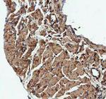 ACTA1 Antibody in Immunohistochemistry (Paraffin) (IHC (P))