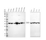 ACTA1 Antibody in Western Blot (WB)
