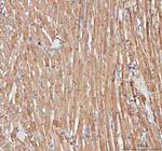 ACTA1 Antibody in Immunohistochemistry (Paraffin) (IHC (P))