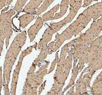 ACTA1 Antibody in Immunohistochemistry (Paraffin) (IHC (P))