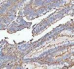 ACTA1 Polyclonal Antibody