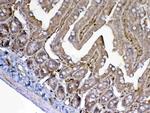 Adenosine Deaminase Polyclonal Antibody