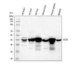 Adenosine Deaminase Antibody in Western Blot (WB)