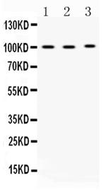 ADAM2 Polyclonal Antibody