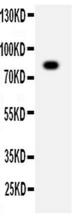 ADAM2 Polyclonal Antibody